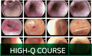 WEO-SIED High-Q Courses
