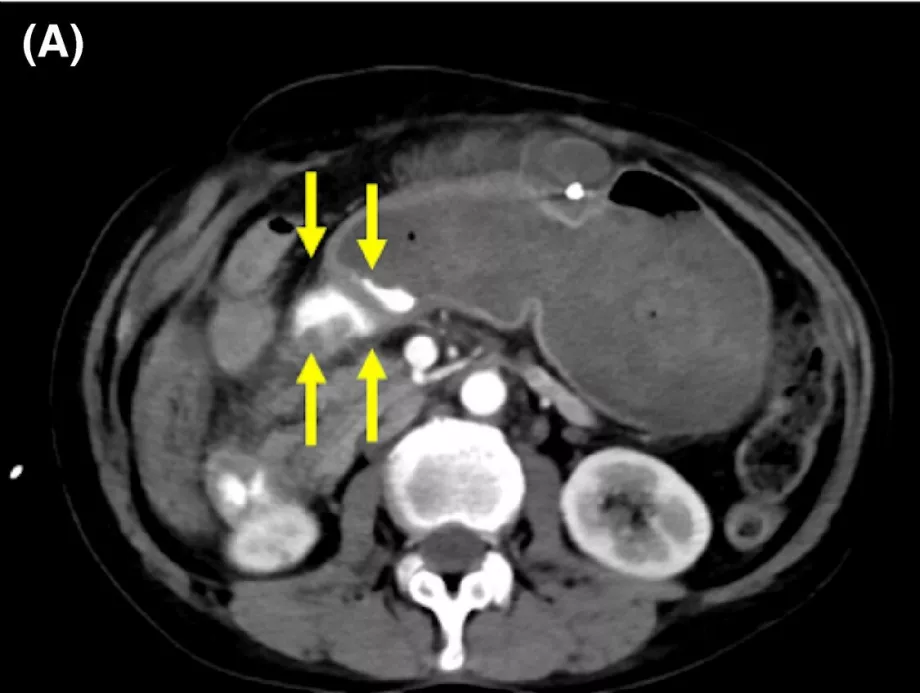 Den digestive endoscopy presentation