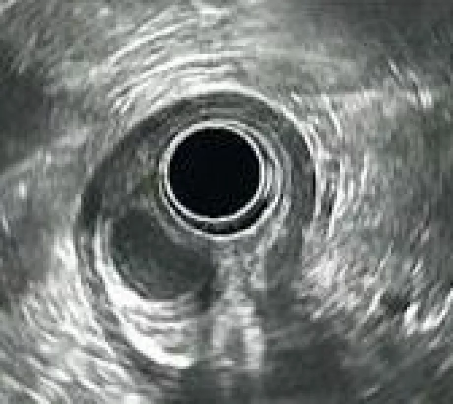 April video endoscopy
