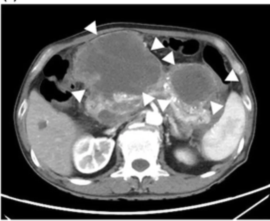 Den december digestive edoscopy