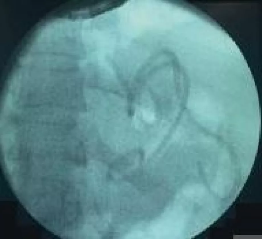 July video endoscopy