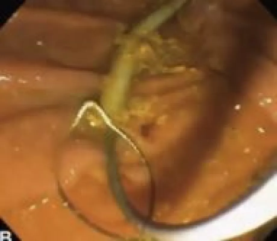 March video videogie