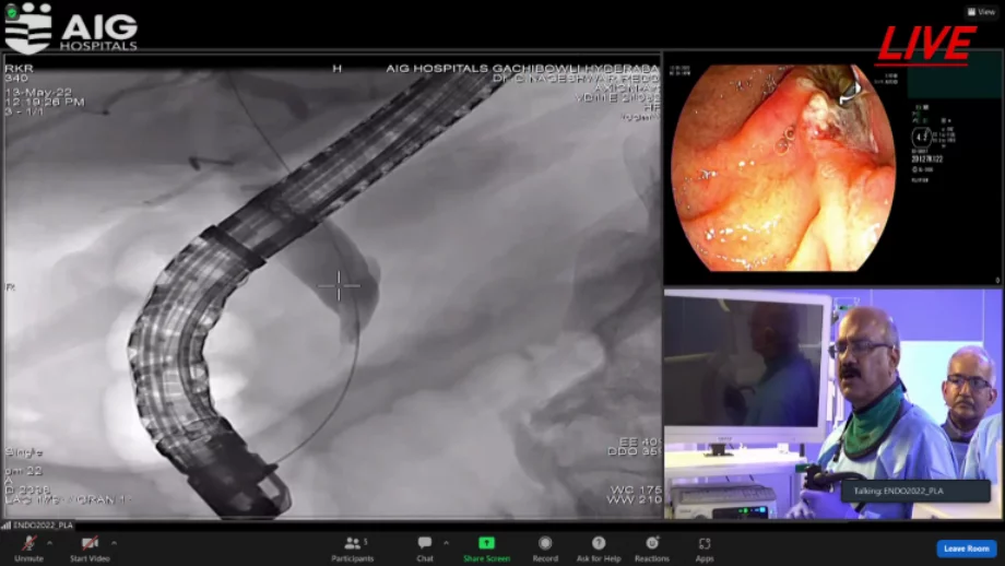 May endo 2022 live demonstration 1