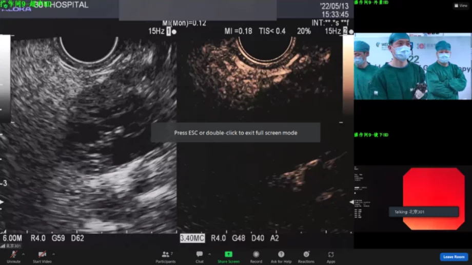 May endo 2022 live demonstration 2