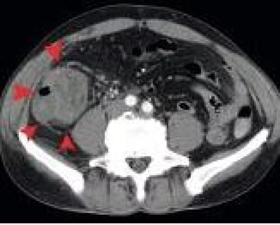 May video endoscopy