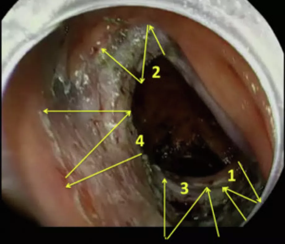 November e video corner video gie