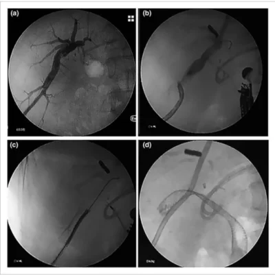 October den digestive endoscopy