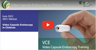 VCE in Children