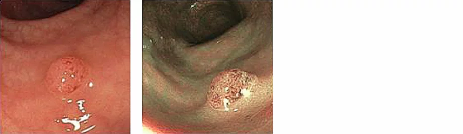 Figure1