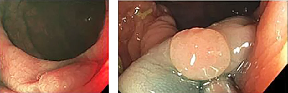 Figure3