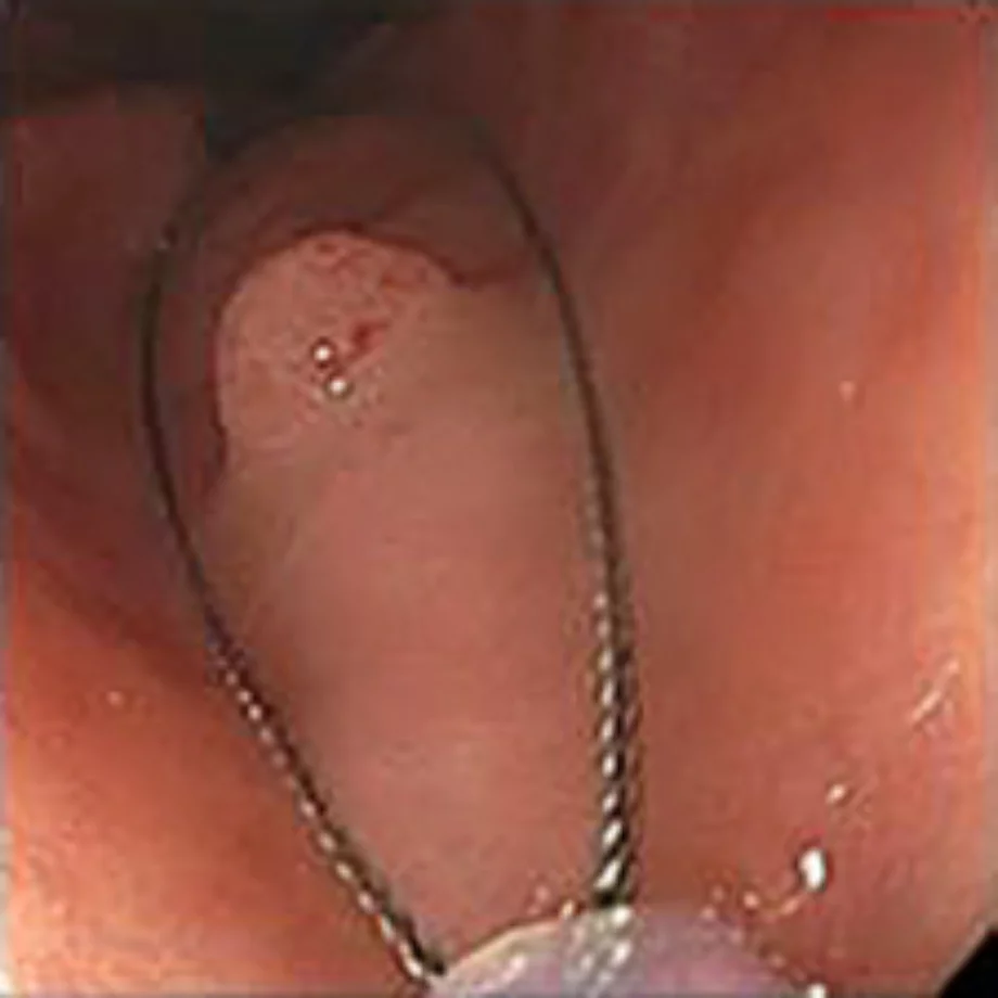 Figure4