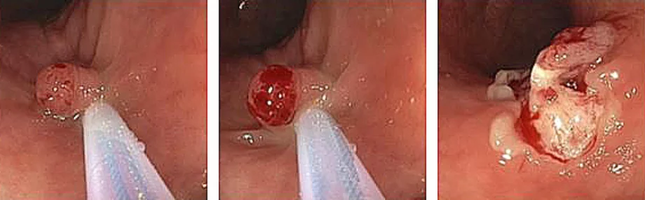 Figure5