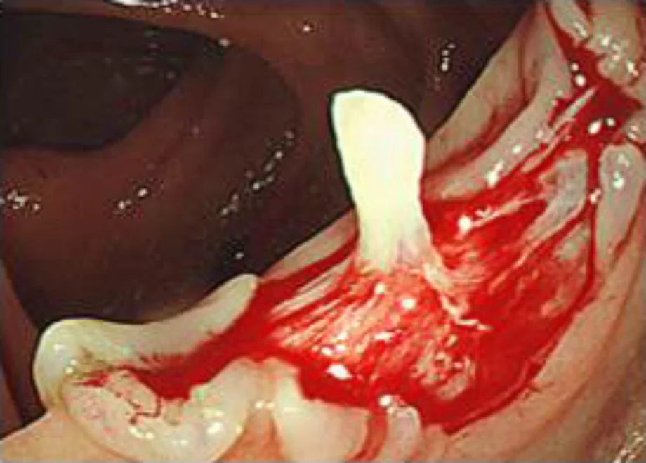 Figure6
