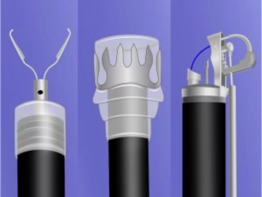 Prevention endoscopic management