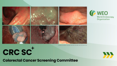 WEO CRC SC: EWG Sessions + Plenary Meeting - Barcelona