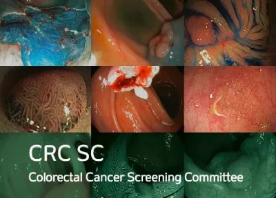 CRC SC