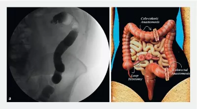 Endoscopy screen shot