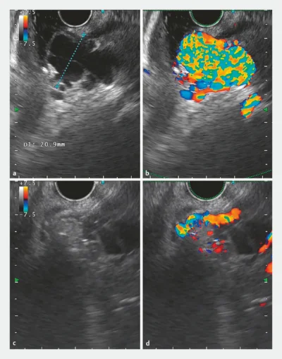 Edoscopy screen shot