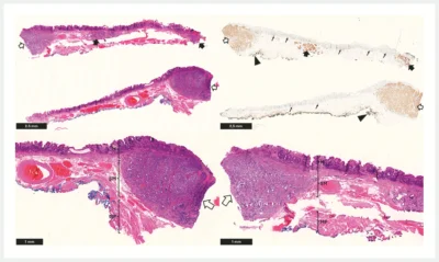 Endoscopy image