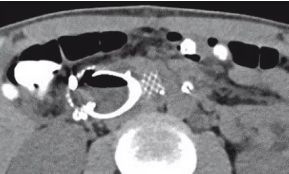 Endoscopy screen shot