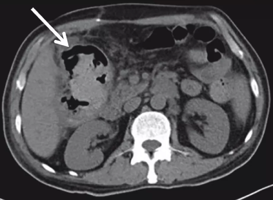 Endoscopy screen shot