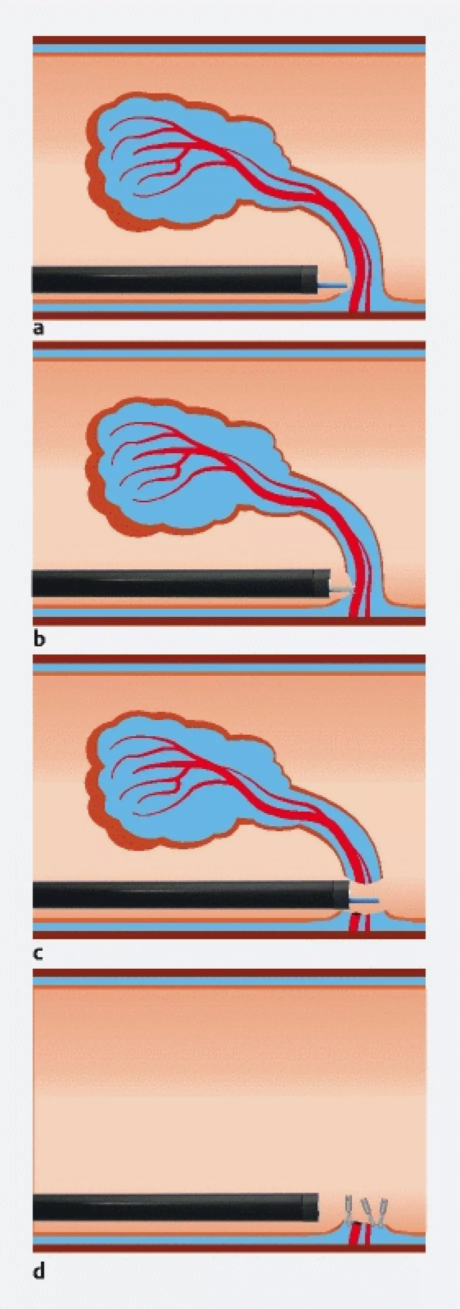 Endoscopy screen shot
