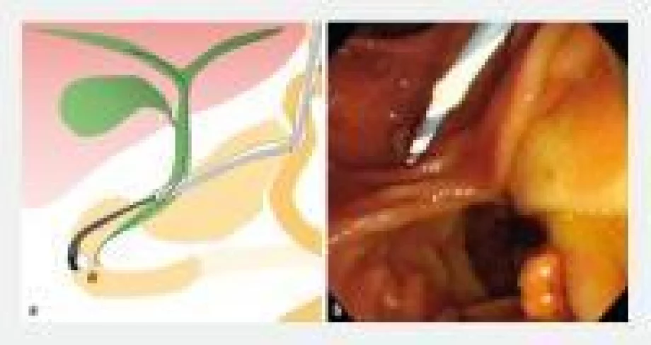 Endoscopy screen shot 2