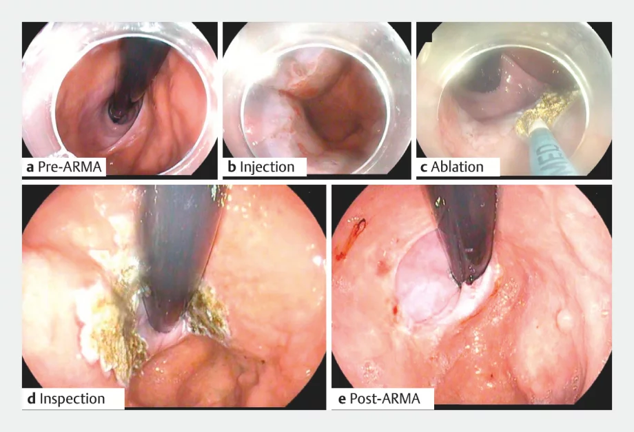 Endoscopy screen shot