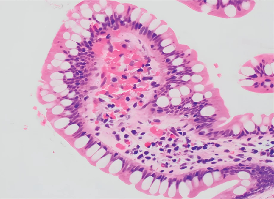 Endoscopy screen shot