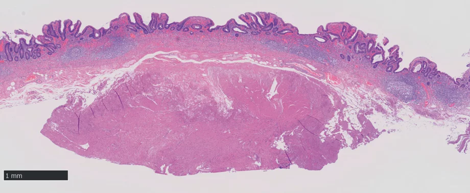 Endoscopy photo