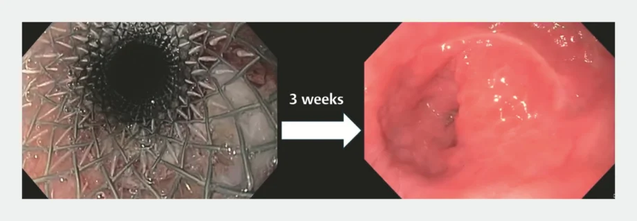 10 1055 a 2615 6134 26162157