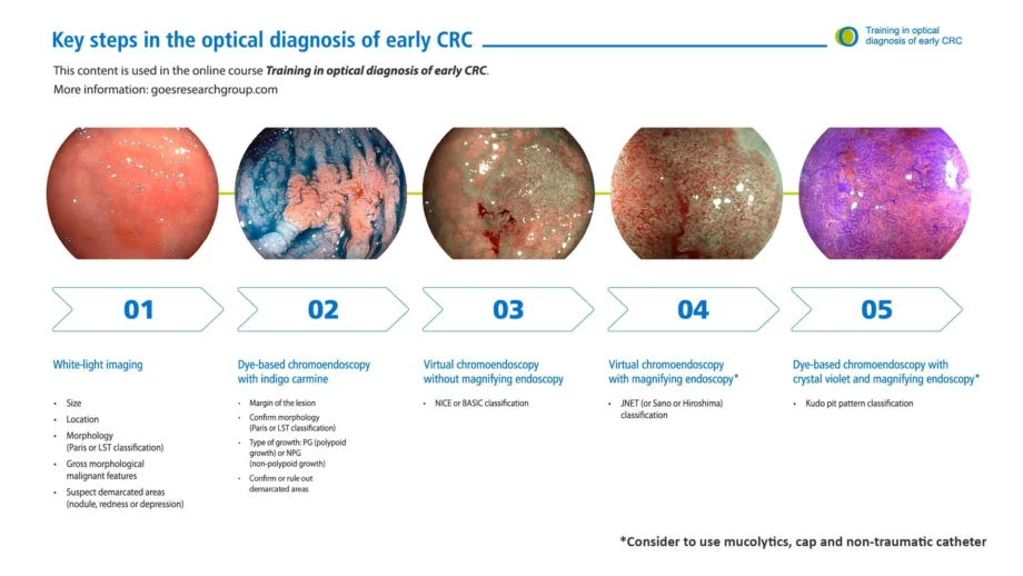 Optical Diagnosis of Early Colorectal Cancer (TOD Early CRC) - Online ...
